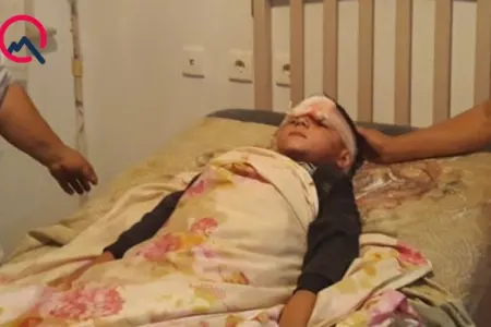 Tovuzda 6 yaşlı uşağı it dişlədi