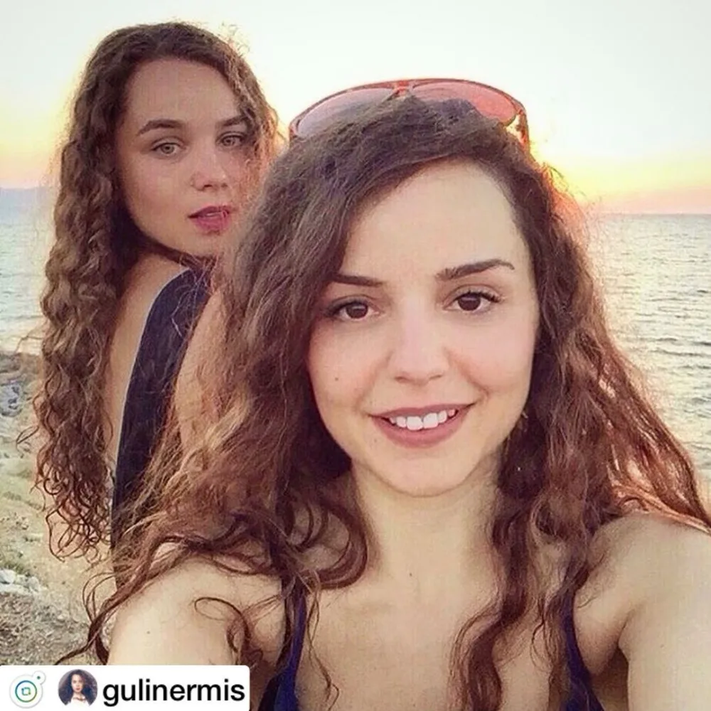 Plastik əməliyyat etdirən "Aşkı-Memnu"nun Cəmiləsi - İLLƏR SONRA - FOTO