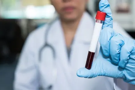 SON DƏQİQƏ! Ölümcül epidemiya - YAYILIR - DÜNYA TƏHLÜKƏDƏ