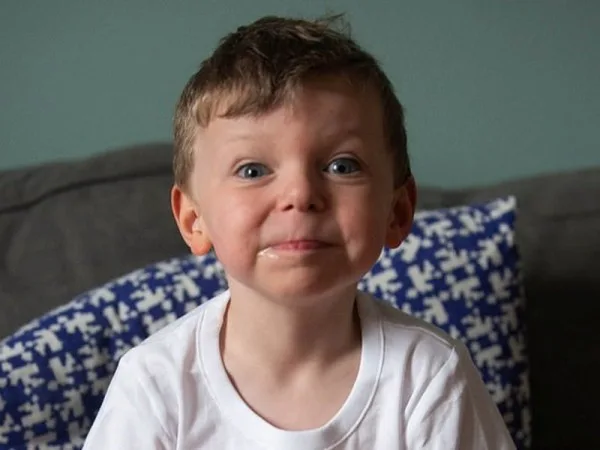 Bu uşaqda - QƏRİBƏ XƏSTƏLİK VAR - FOTO