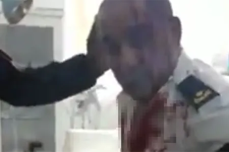 Xəsarət alan SOCAR əməkdaşlarına tibbi yardım - Açıqlama