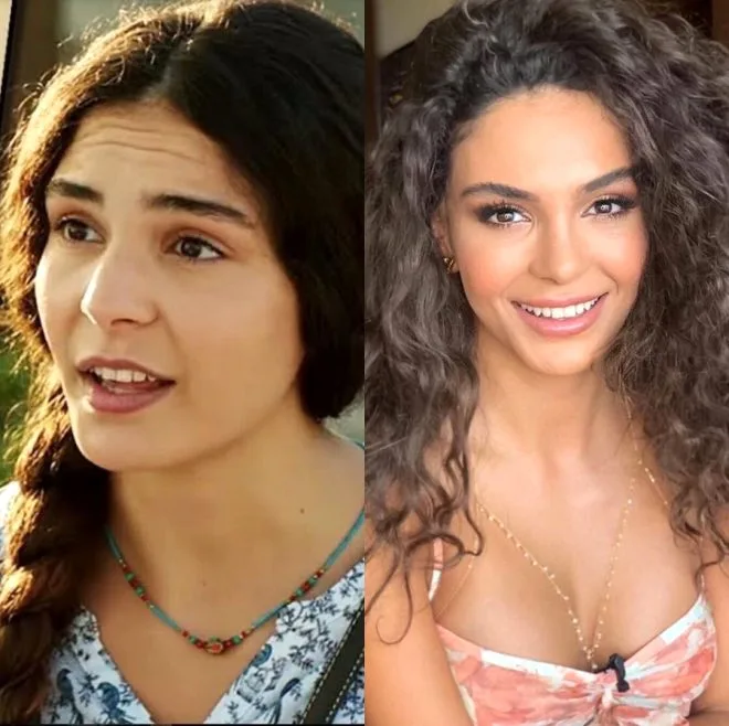 "Hercai"nin Reyyanını bir də - PLASTİK ƏMƏLİYYATSIZ GÖRÜN - FOTO
