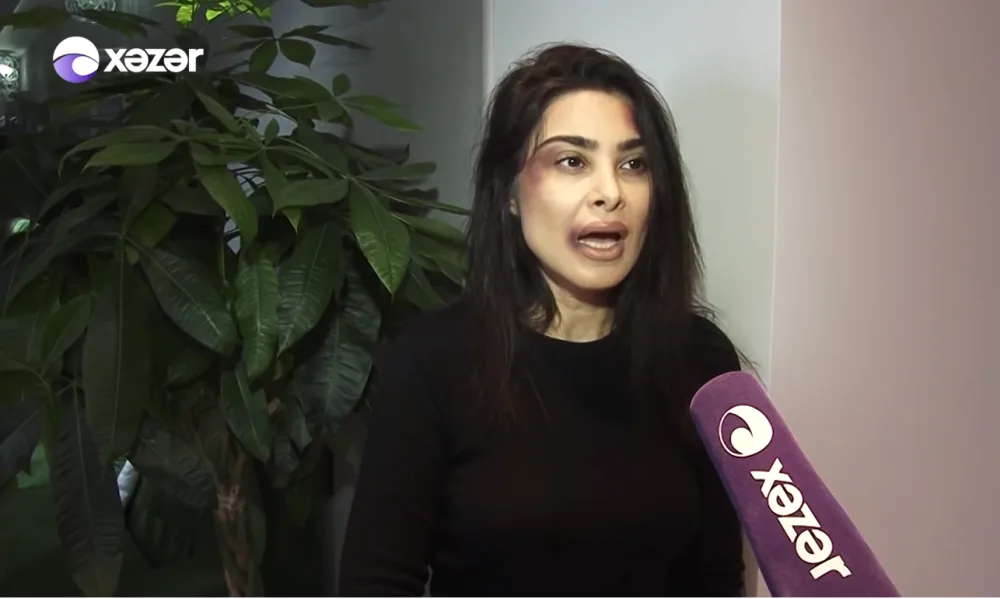 "Üstümə bıcaq çəkdi..." - Əri döyən azərbaycanlı məşhurdan ŞOK FAKTLAR - VİDEO