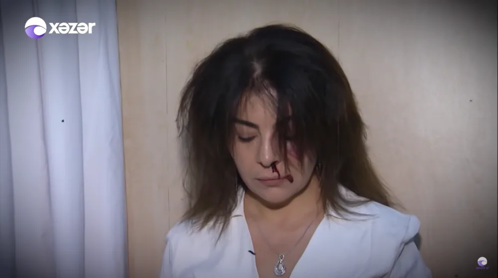 "Üstümə bıcaq çəkdi..." - Əri döyən azərbaycanlı məşhurdan ŞOK FAKTLAR - VİDEO
