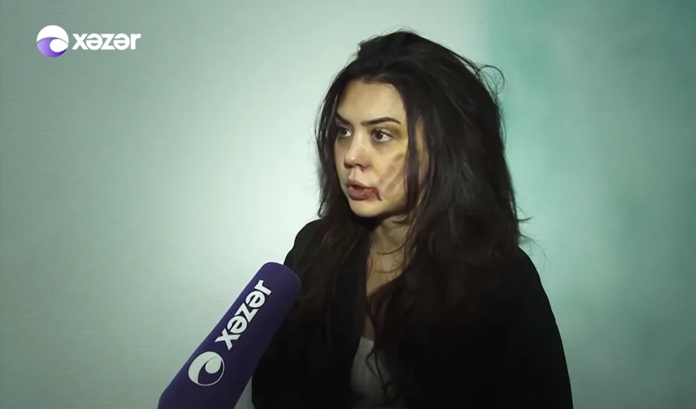 "Üstümə bıcaq çəkdi..." - Əri döyən azərbaycanlı məşhurdan ŞOK FAKTLAR - VİDEO