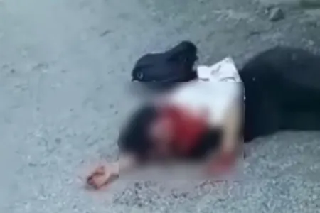 Küçədə boğazı kəsilən qadın sağdır - Rəsmi açıqlama