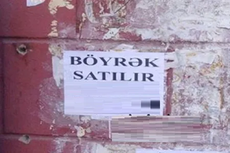 Bakıda böyrəyini satışa çıxaran qadınla bağlı - ŞOK XƏBƏR