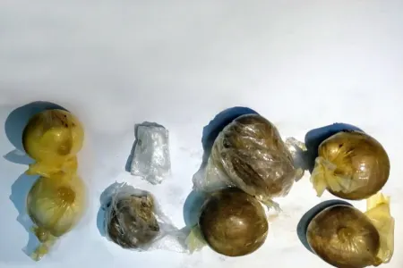 Bağırsağında 7 büküm heroin - KEÇİRMƏK İSTƏDİ