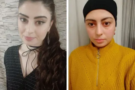 Rəssamlar "Həyata ümid" deyəcəklər - FOTO