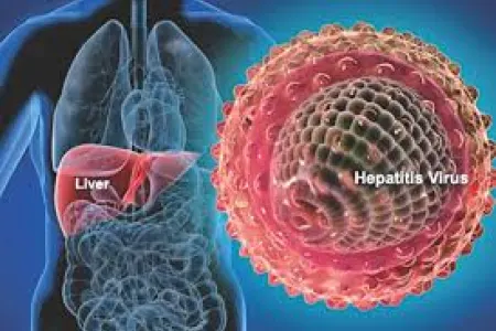 5 ildə 10 mindən çox insanda viruslu hepatit aşkarlanıb- - Azərbaycanda