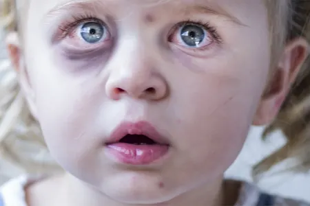 Dövlət Komitəsi uşaq hüquqları ilə bağlı qanunvericiliyin sərtləşdirilməsini - TƏKLİF EDİB