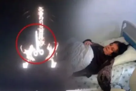 Azərbaycanda əməliyyatda qadının bədənində qayçı qalıbmış - FOTOLAR