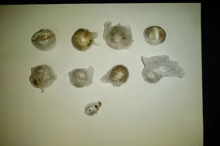 Daxili orqanında heroin və tiryək keçirmək İSTƏDİ - FOTO