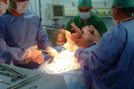 Lənkəranda ana doğuşdan sonra ÖLÜB