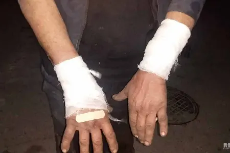 Bakıda canavarın hücum etdiyi kişi danışdı: - "Boğub öldürdüm sonra isə..." - FOTO - VİDEO