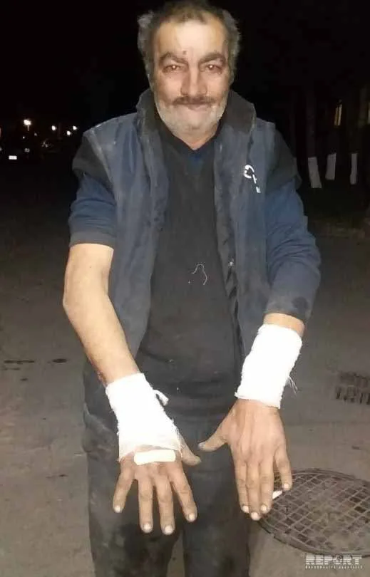 Bakıda canavarın hücum etdiyi kişi danışdı: - "Boğub öldürdüm sonra isə..." - FOTO - VİDEO