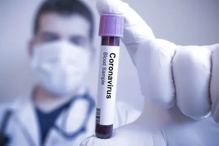 Koronavirusla bağlı mətbuat konfransı - KEÇİRİLƏCƏK