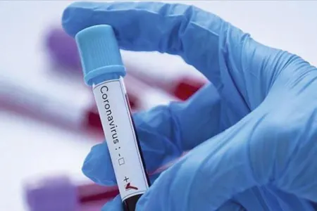 Azərbaycanda daha 9 nəfərdə koronavirus aşkarlandı