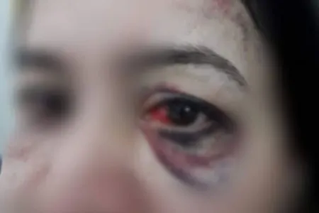 Sosial şəbəkələrdə fotosu yayılan qadınla bağlı cinayət işi açıldı