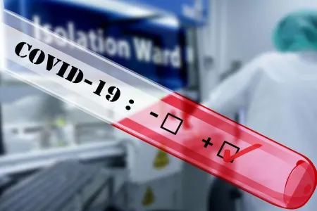 İspaniyada 9,5 minə yaxın tibb işçisi - KORONAVİRUSA YOLUXDU