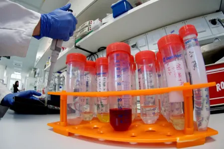 Azərbaycanda koronavirusa görə 25 mindən artıq test edilib
