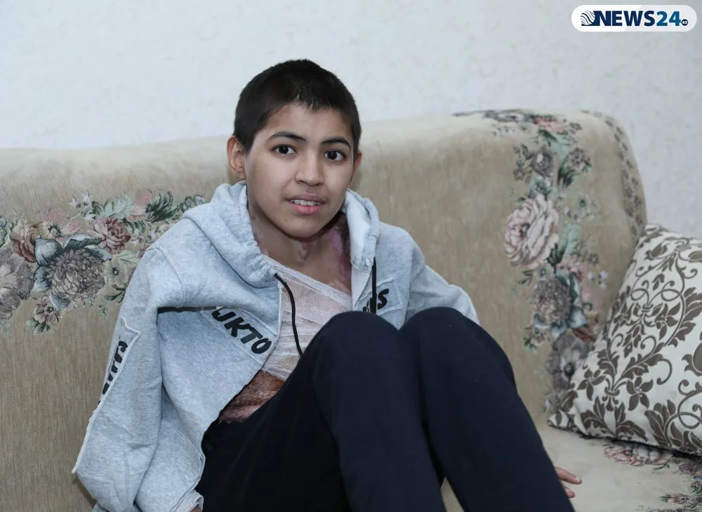 “Oğlumun ayağa qalxması möcüzədir”- Transfarmatorda yanan uşaq SAĞALDI - VİDEOREPORTAJ - FOTOLAR