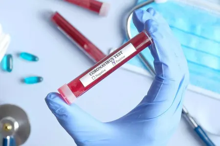 Azərbaycanda daha 49 nəfər koronavirusa yoluxub - 1 NƏFƏR ÖLDÜ