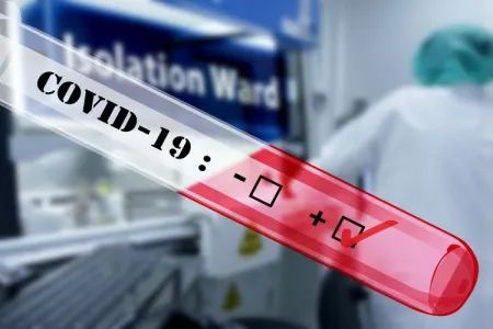 Azərbaycanda daha 38 nəfərdə koronavirus - AŞKARLANDI