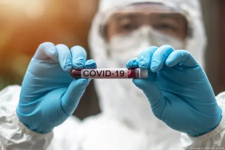 Azərbaycanda daha 77 nəfərdə koronavirus - AŞKARLANDI