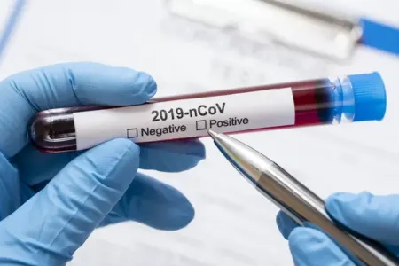 Daha 65 nəfərdə koronavirus aşkarlandı - 2 NƏFƏR ÖLDÜ