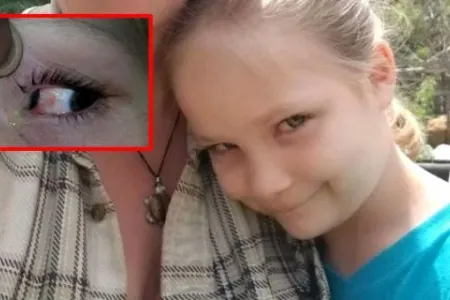 ŞOK! 6 yaşlı uşağın gözündən - BÖCƏK ÇIXDI - FOTOLAR