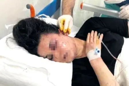 Boşanma faciəsi - ƏRİ VƏ QAYNI QADINI MEŞƏYƏ APARIB...