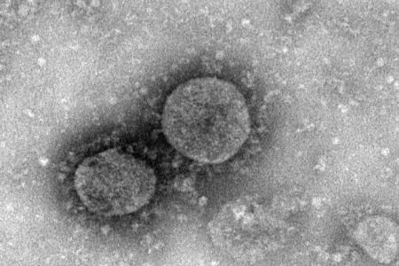 ABŞ-da yeni ölümcül virus - YAYILMAĞA BAŞLADI - VİDEO