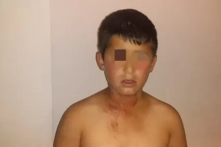 Ata dilənmək istəməyən 11 yaşlı oğlunu başından - BIÇAQLADI