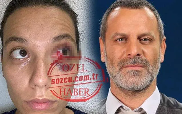 "Səni öldürəcəm..." - MƏŞHUR AKTYOR SEVGİLİSİNİ DÖYDÜ - FOTO