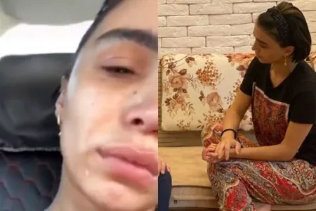Depressiyaya düşən Renka bunu da - ETDİ