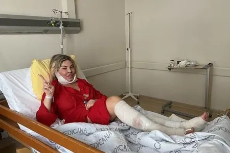 Kişi özünü "Barbi"yə oxşatmaq istədi, amma... - FOTOLAR