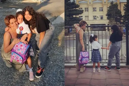 Lalə Məmmədova burun əməliyyatdan sonra ilk dəfə - FOTOLAR