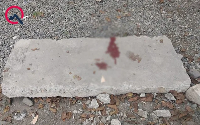 Ermənilərin atdığı mərmi daha bir məktəblini öldürdü - Fotolar