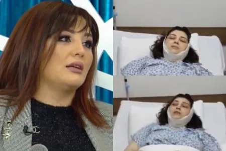 Səidə plastik əməliyyat - ETDİRDİ