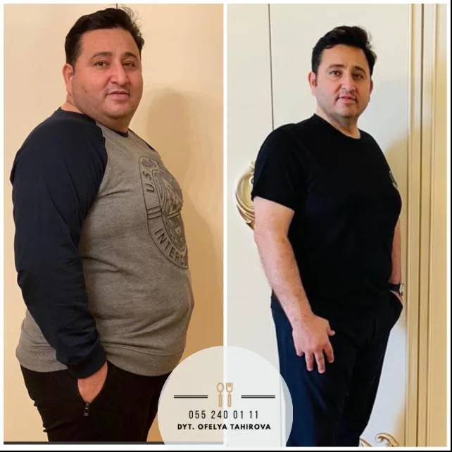 Dörd aya 32 kilo çəki verən müğənni: - "YENƏ ARIQLAYACAĞAM..." - FOTO