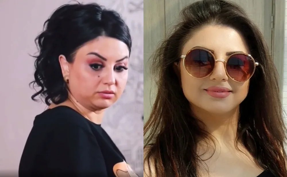 Xəyalə əməliyyatdan sonra belə oldu