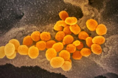 Koronavirusun yeni ştamı bu ölkədə də ÜZƏ ÇIXDI