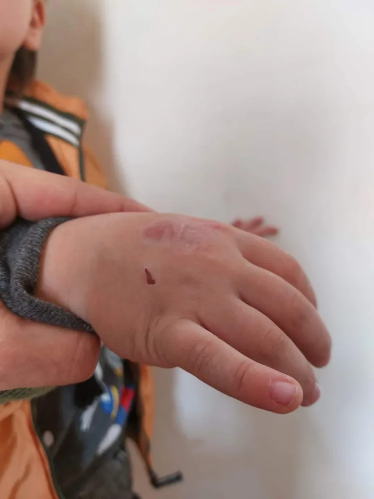 "Nənəm qazı açıb, isti bıçaqla əlimi yandırır" - Azərbaycanda 5 yaşlı uşağa - DƏHŞƏTLİ İŞGƏNCƏ VERİLDİ