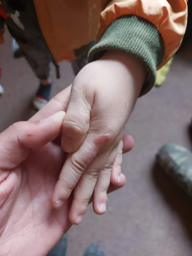 "Nənəm qazı açıb, isti bıçaqla əlimi yandırır" - Azərbaycanda 5 yaşlı uşağa - DƏHŞƏTLİ İŞGƏNCƏ VERİLDİ