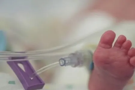 Seneqalda xəstəxanada baş verən yanğında - 11 yeni doğulmuş körpə ölüb