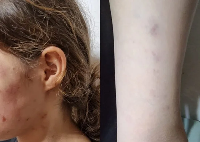 Məktəbli qızın icra başçısının müavini tərəfindən döyüldüyü təsdiqləndi - RƏSMİ