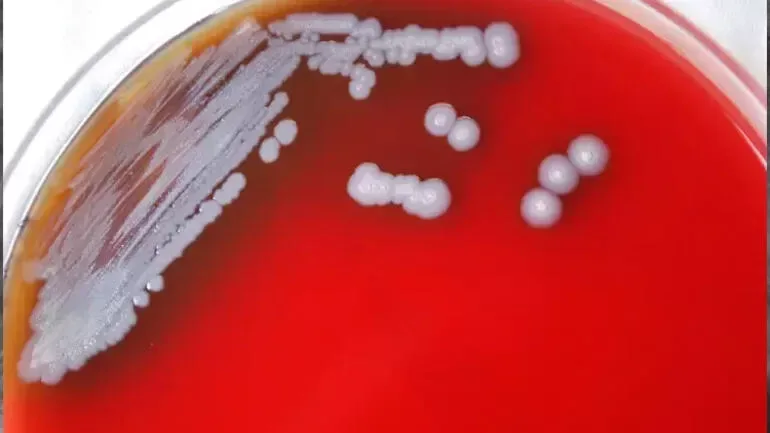 Yeni ölümcül bakteriya aşkarlandı
