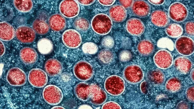 Ev heyvanı meymunçiçəyinə yoluxdu – virus mutasiyaya uğrayır