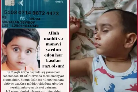 "Mərhəmətli insanlar, yeganə balamı ölməyə qoymayın" - 2 yaşlı Mirsəccadın - YARDIMA ehtiyacı var - FOTO/VİDEO